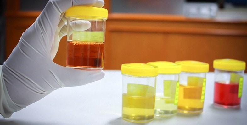 Noxide Synthetic 
      Urine Delozier Acres Springdale AR